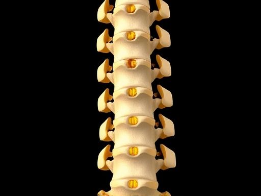 胸椎黄韧带骨化症